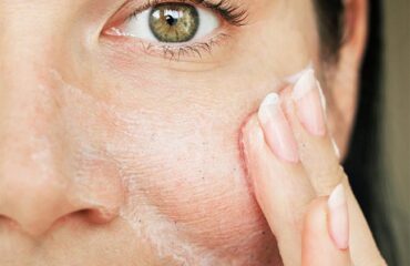 Woman applying face cream